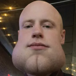 Squeekcheek